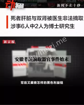 器官交易