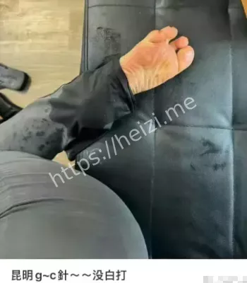 私密整形