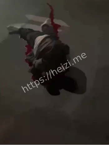 两轮车护栏二次伤害科普