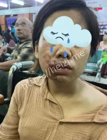 缅北果敢园区暴行曝光