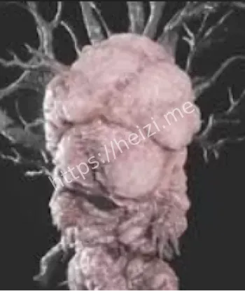 沙民感染者围攻气象站