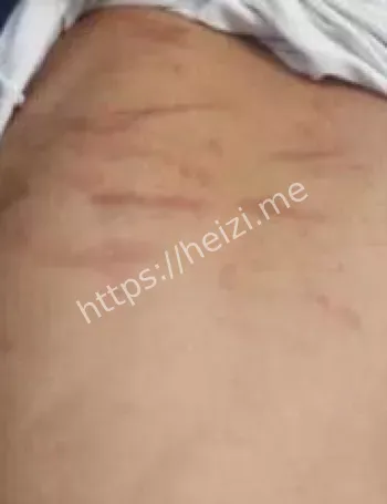 40岁单亲妈妈虐待10岁女儿