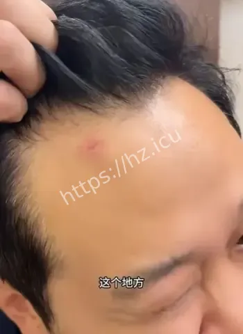 球迷遭飞车党枪顶脑门