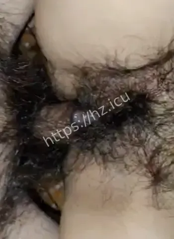 私生活混乱常年出轨致前任染上梅毒